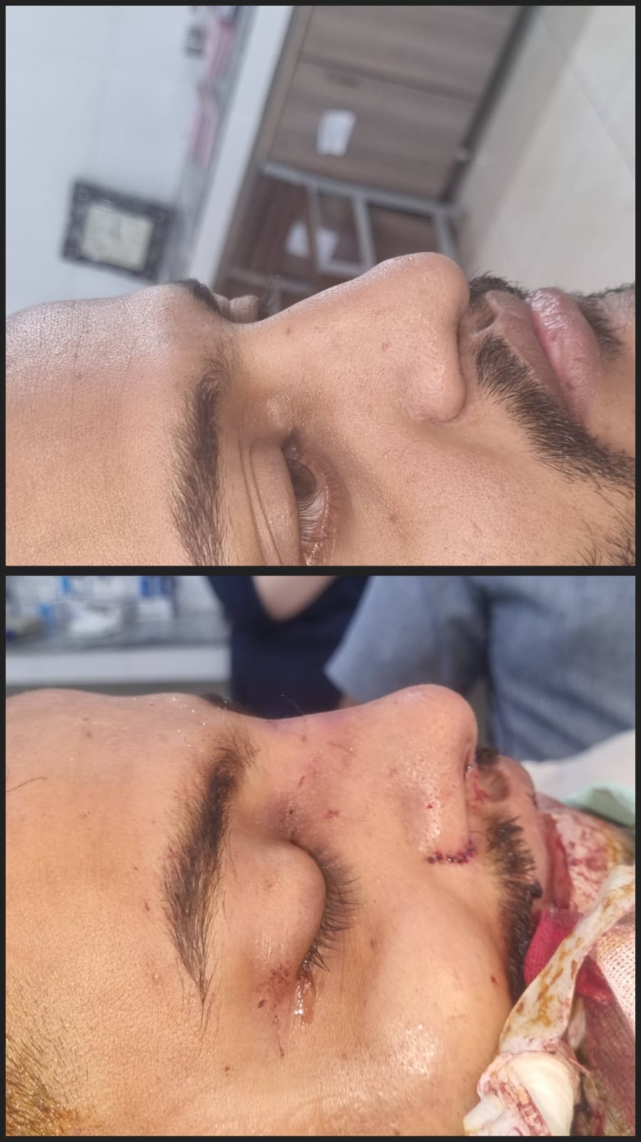 Before & After 73